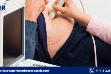 Global Portable Ultrasound Market Share, Price, Trends, Growth, Analysis, Key Players, Outlook, Report, Forecast 2023-2028