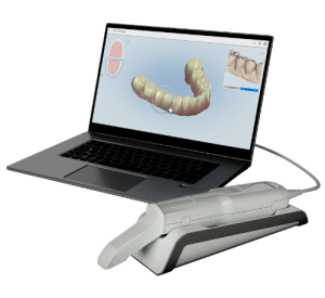 Where to Buy an Intraoral Scanner
